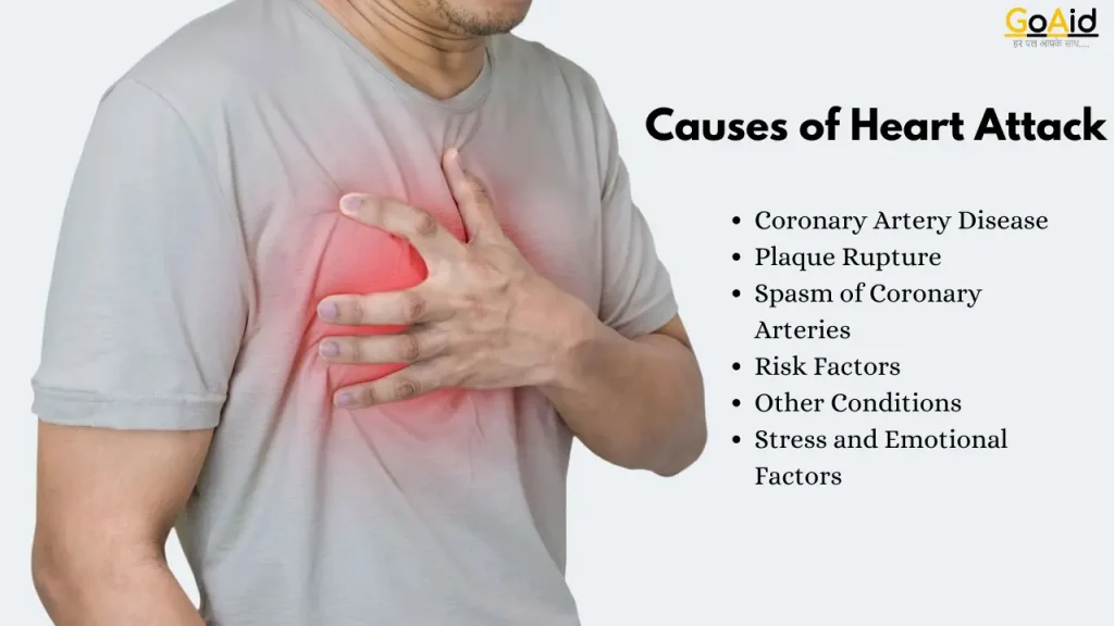 Causes of Heart Attack 