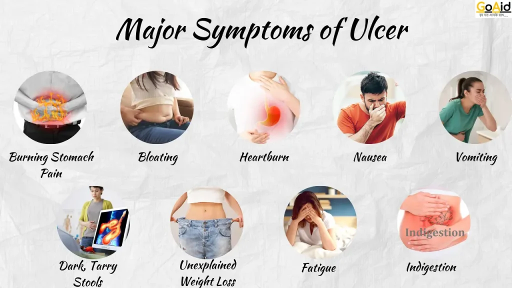 Major Symptoms of Ulcer